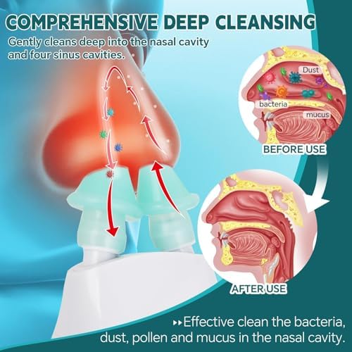 Nasal Irrigation System with 30 Saline Packets Nasal Care, Sinus Rinse Machine, Nasal Rinse Machine, Nasal Cleaner with Auto Waste Collection Function for Sinus, Nasal Allergies - Green