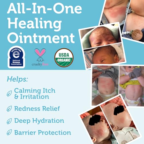 Superbalm USDA Organic Healing Ointment for Baby Eczema & Cradle Cap - 2oz | 100% Natural Soothing Superfood Cream for Toddler & Kids - Eczema, Cradle Cap, Baby Acne & Rashes - Non-Toxic, Fragrance-Free