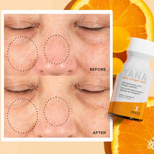 IMAGE Skincare, YANA Liquid Collagen Shots, 28 Daily Shots | 2500 mg Hydrolyzed Bovine Collagen Peptide Supplement with Biotin, Natural Citrus Flavor