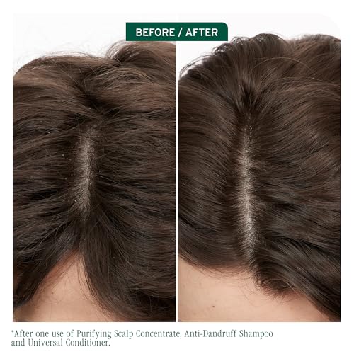 Biolage Scalp Sync Anti-Dandruff Shampoo – Controls Dandruff | Controls Itchy Scalp, Cleanses Hair, Moisturizing, Dandruff Relief, For Scalp and Hair Health, Vegan & Cruelty-Free