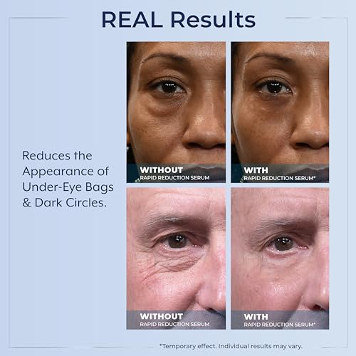 Plexaderm Eye Serum, 30 Single Use Pods - Visibly Reduces Bags & Wrinkles