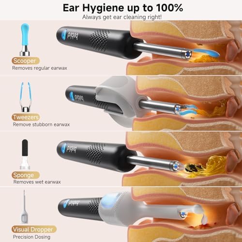 BEBIRD R1 Ultra Ear Wax Removal Tweezers:1296P HD Ear Camera Cleaner, Black
