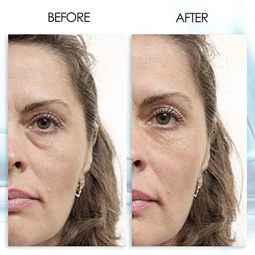 Puffy Eye GEL Instant results – Naturally rapid reduction eye gel, Eliminate Wrinkles