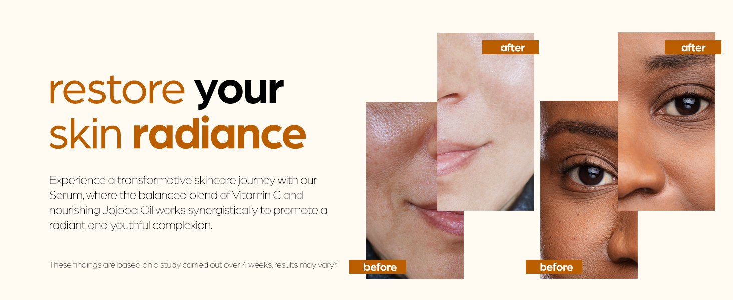 Anti-Aging Vitamin C Serum