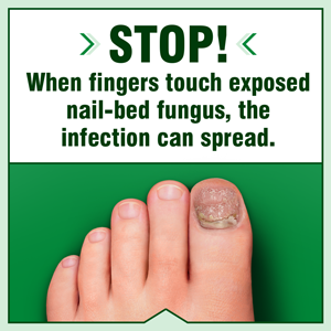 fungicure liquid gel ringworm athletes foot