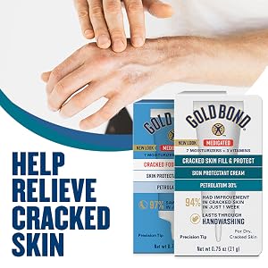 How to heal cracked and bleeding skin