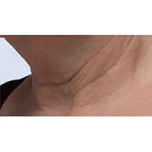 Peter Thomas Roth, Potent-C Power Serum, neck, before