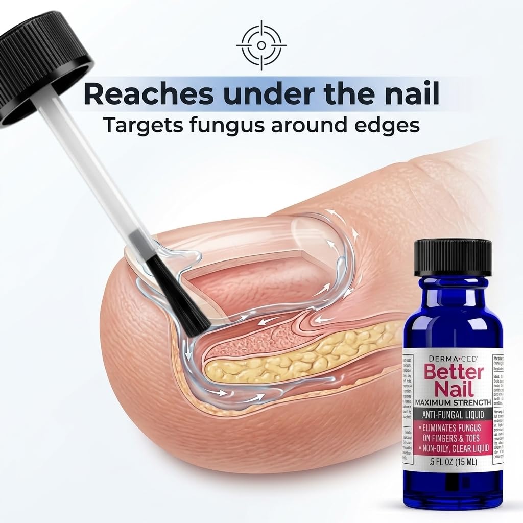 Better Nail - Treatment for Fungus Under & Around the Nail - Maximum Strength, 25% Anti Fungal Solution for Nail Support, Nail Restoring
