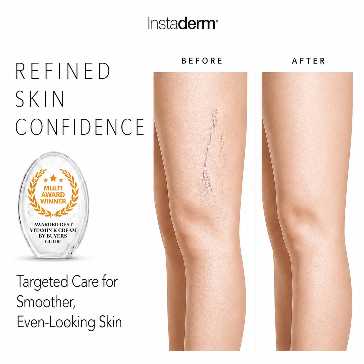 Vitamin K Cream-Revitalizing Formula with Arnica for the Appearance of Brusing, Spider Veins, Broken Capillaries