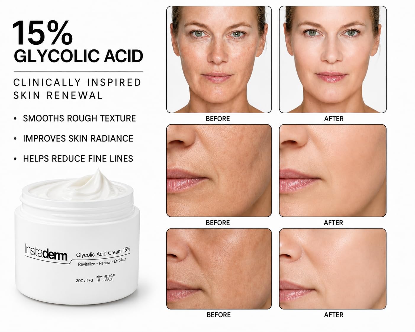 Glycolic Acid 15% Anti-Aging AHA Wrinkle Cream – Reduces the Appearance of Fine Lines, Wrinkles, Age Spots & Dark Spots – Exfoliates, Smooths