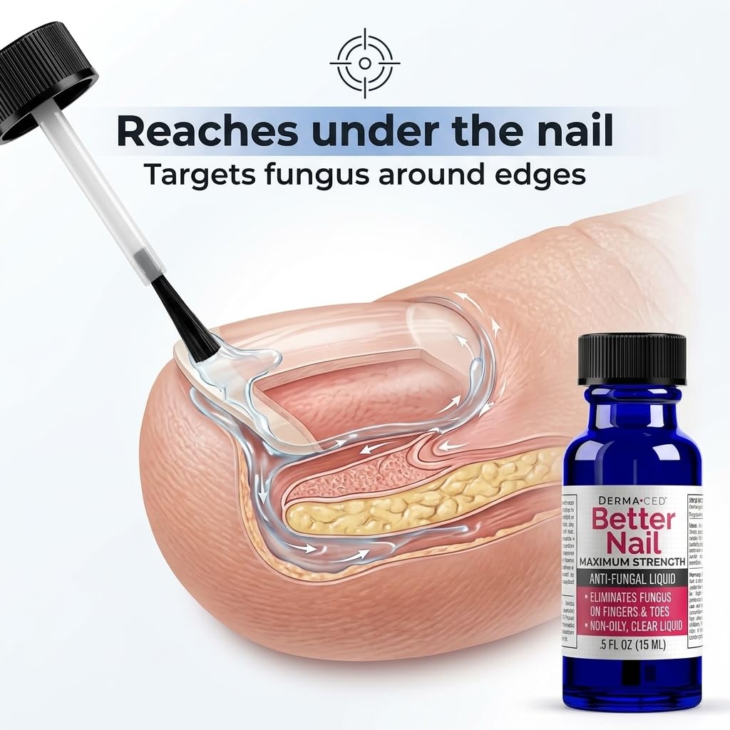 Better Nail - Treatment for Fungus Under & Around the Nail - Maximum Strength, 25% Anti Fungal Solution for Nail Support, Nail Restoring