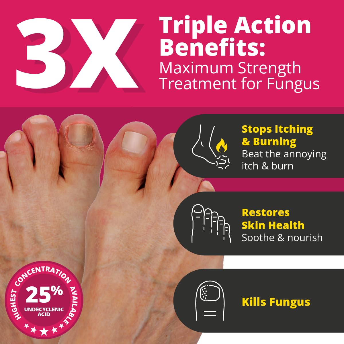 Better Nail - Treatment for Fungus Under & Around the Nail - Maximum Strength, 25% Anti Fungal Solution for Nail Support, Nail Restoring