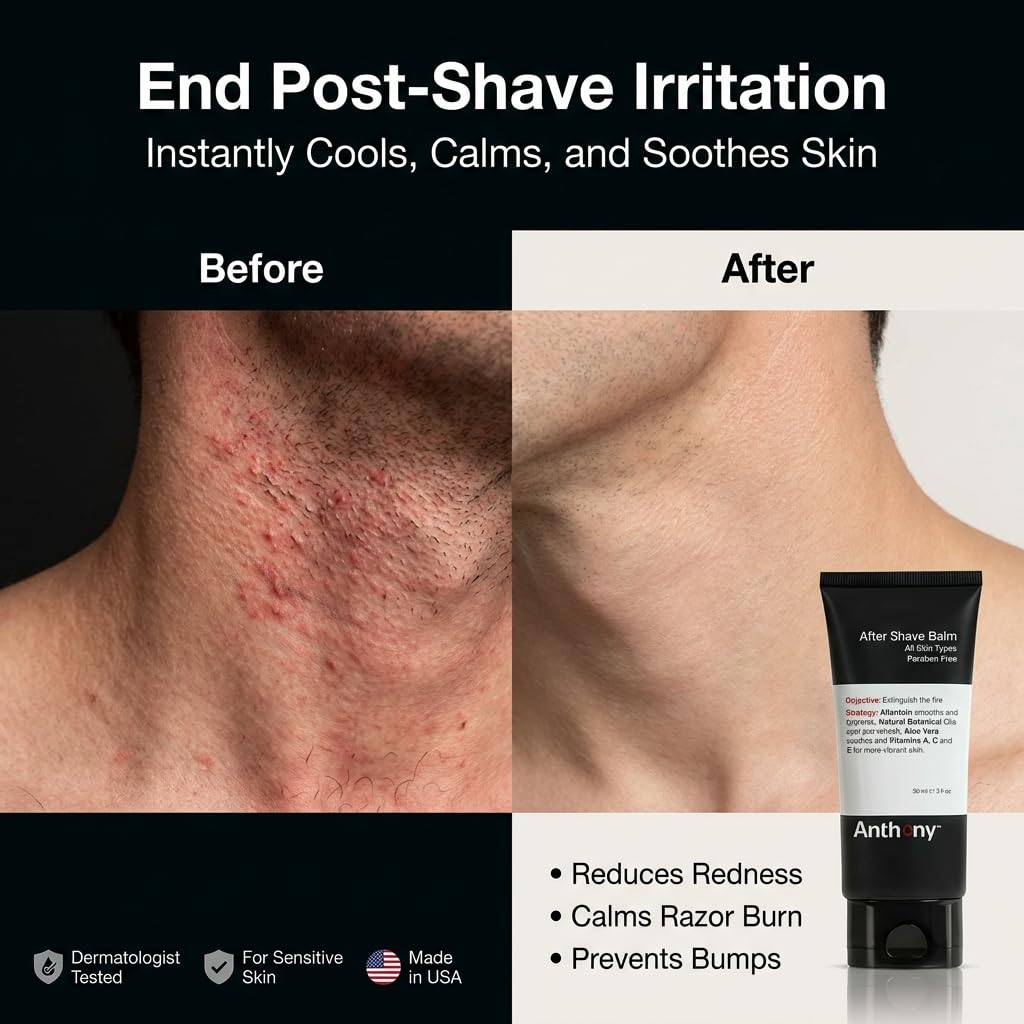 Anthony After Shave Balm for Men, Cooling & Hydrating Lotion with Vitamins A, C & E, Aloe Vera & Botanical Extracts, 3 fl oz, Aftershave Soothes