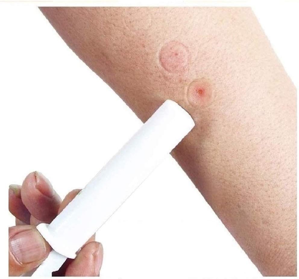 2PK Mosquito Bee Sting Bug Bite Kit Suction Tool Safety Supplies Natural First Aid for Hiking Backpacking Camping