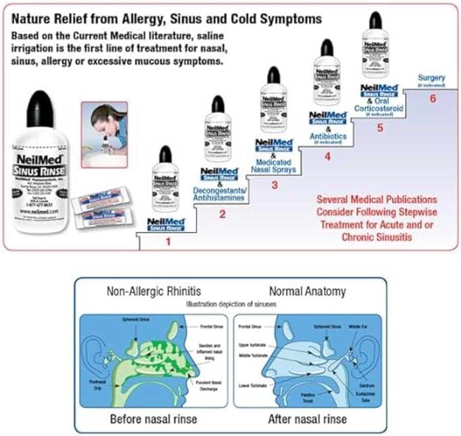 NeilMed Sinus Rinse All Natural Relief Premixed Refill Packets 100 Count (Pack of 1)