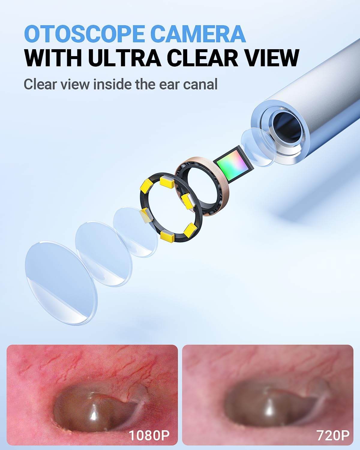 ScopeAround Otoscope with 4.5" IPS Screen, 3.9mm Ear Camera with Gyroscope
