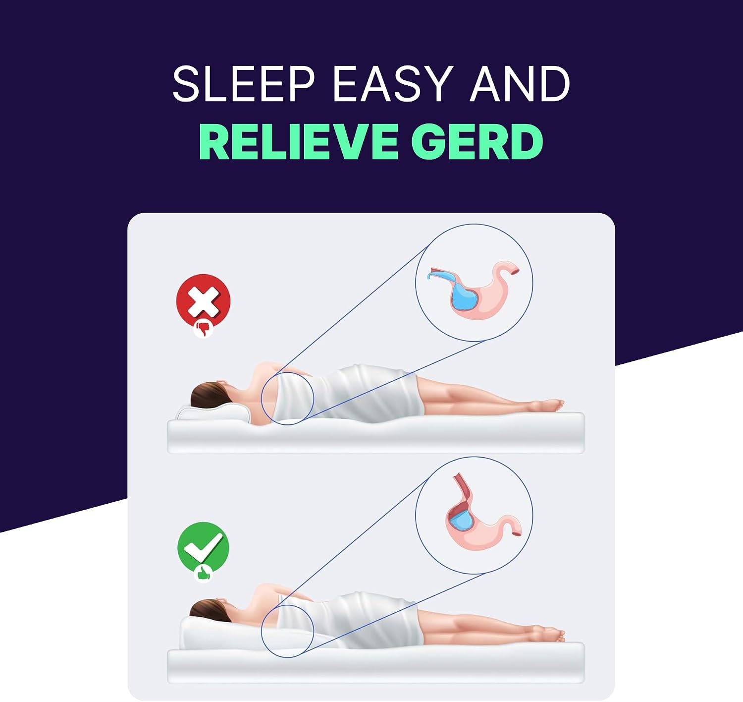 Acid Reflux Wedge Pillow for Sleeping & Sitting – Elevating Memory Foam Pillow for GERD Relief, Snoring, & Back Pain (Side Sleeping Wedge