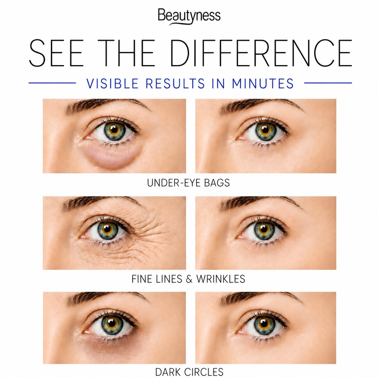 Instant Ageless Eye Cream – Anti Wrinkle Cream, Removes Under Eye Puffiness, Bags, Expression Lines