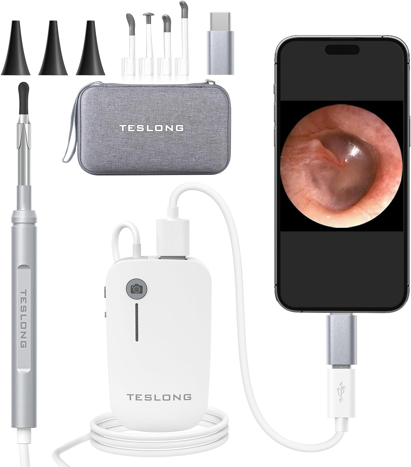 Digital Otoscope with Light 1080P Full HD Otoscope Camera for USB-C Devices | 4.3mm Lens, 6 LED Lights, Waterproof Ear Camera for Ear Viewing