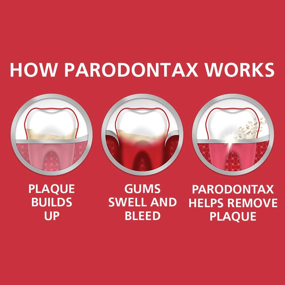 Parodontax Toothpaste for Bleeding Gums, Gingivitis Treatment and Cavity Prevention, Clean mint - 3.4 Ounces