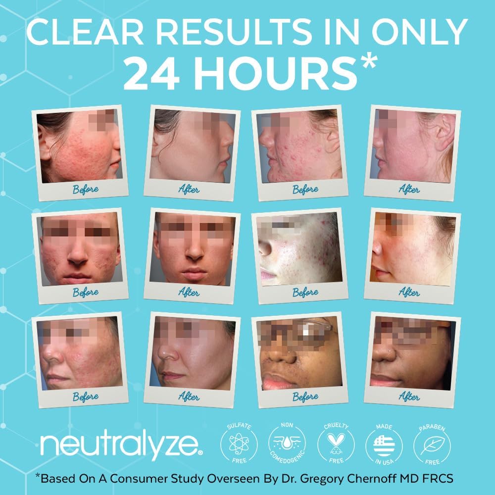 Neutralyze Acne Moisturizer with Time-Release Salicylic Acid, 3.4 fl oz