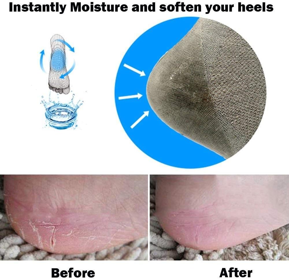 Codream Vented Moisturizing Socks Lotion Gel for Dry Cracked Heels 2 Pairs | Spa Gel Socks Humectant Moisturizer Heel Balm Foot Treatment Care Heel