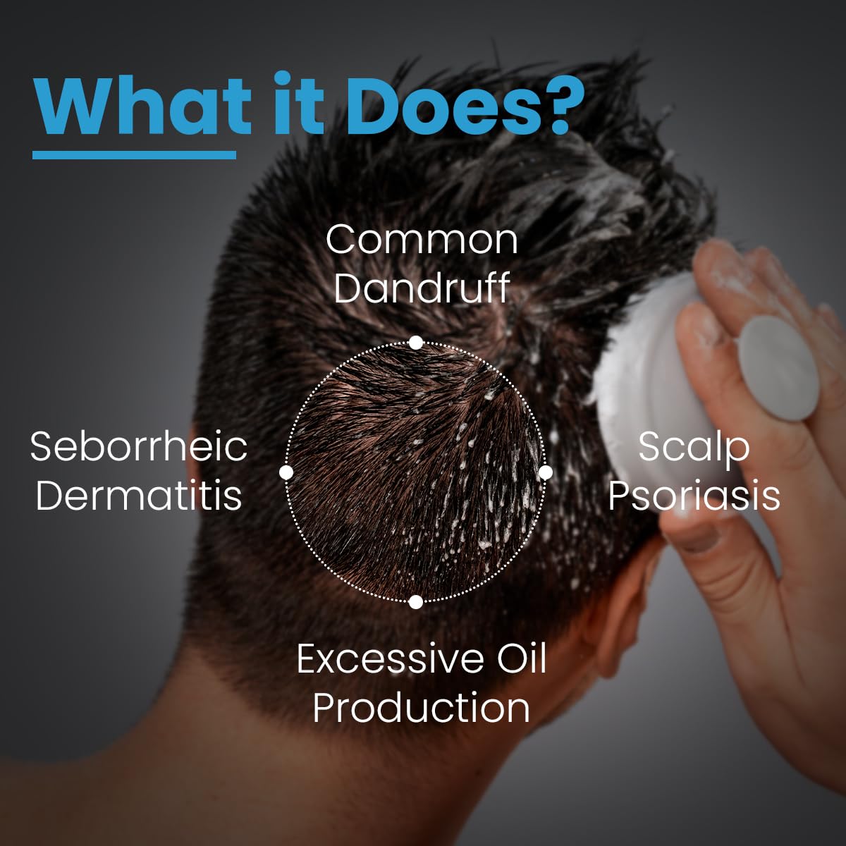 FCL 2% Salicylic Acid T-Shampoo with 1% Tea Tree Oil | Dandruff Shampoo