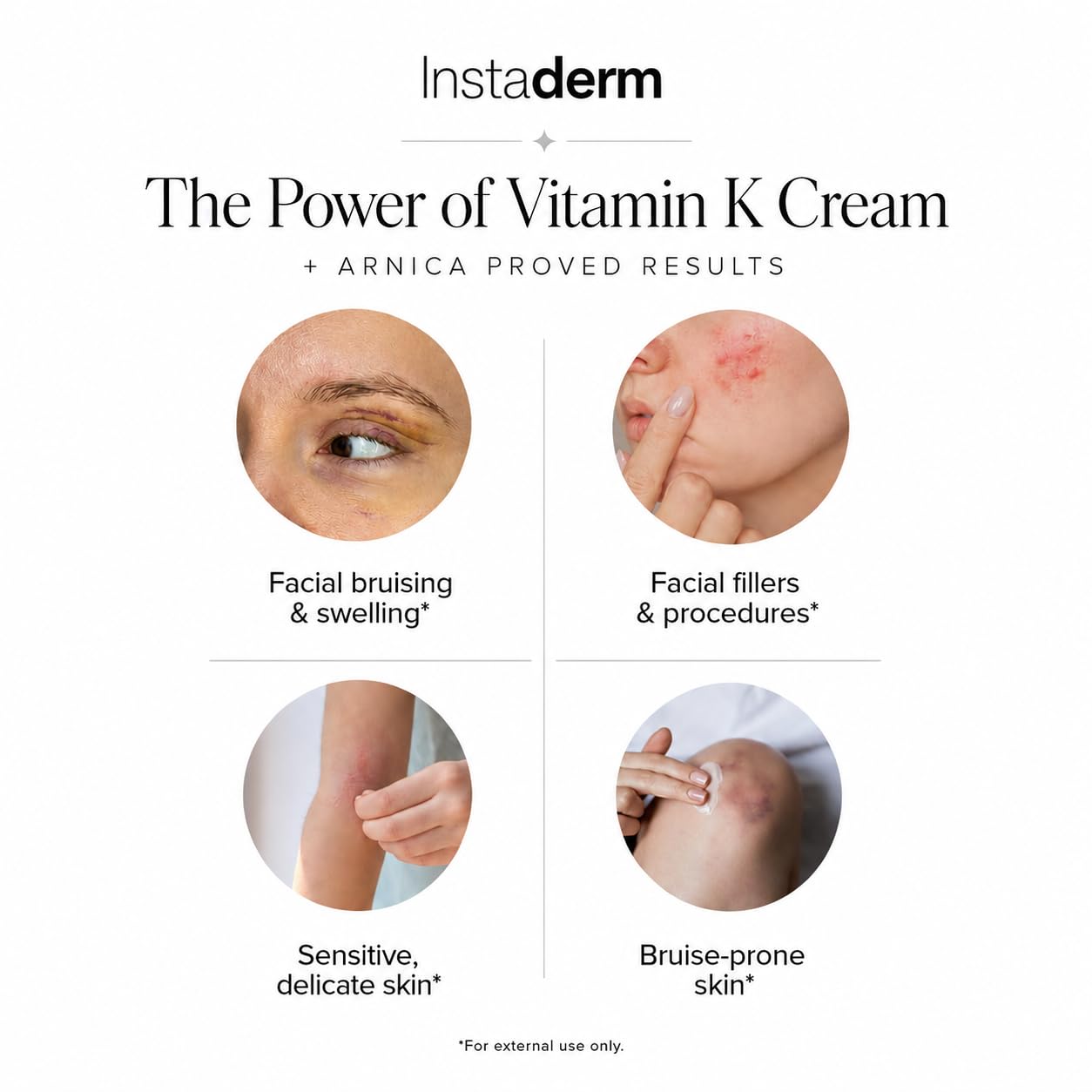 Vitamin K Cream-Revitalizing Formula with Arnica for the Appearance of Brusing, Spider Veins, Broken Capillaries