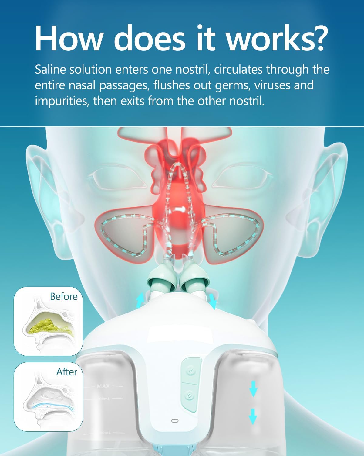 Sonmol Nasal Irrigation System with 50 Salt Packets for Congestion Relief | 2 Modes Sinus Rinse Machine, Self-Cleaning Nose Cleaner for Adult