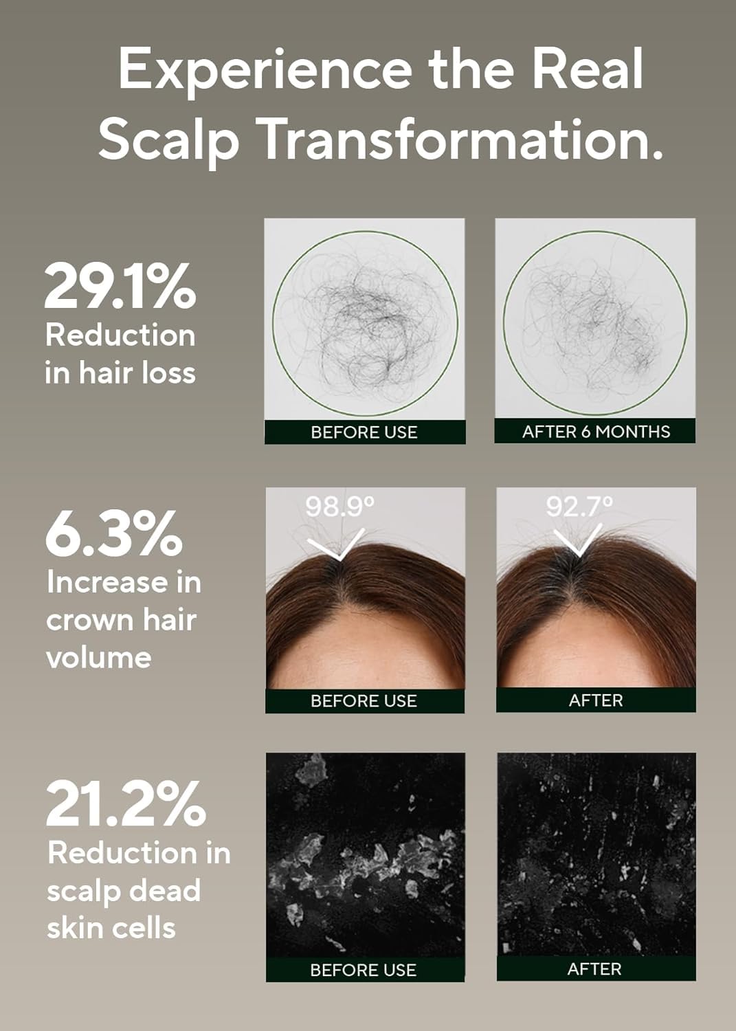 AROMATICA Rosemary Scalp Scaling Shampoo for Hair Growth | Korean Hair Care for Thinning Hair & Hair Loss, Natural Essential Oil, Vegan, Sulfate Silicone Paraben Free (13.53 oz)