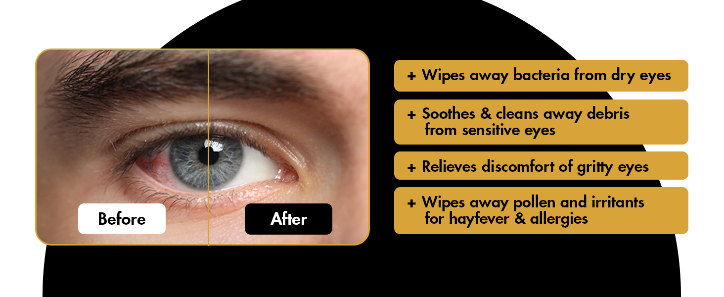Eye wipes
