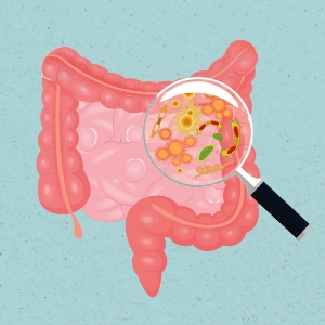 Probiotic Support