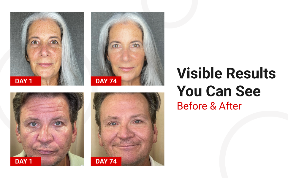 before and after images