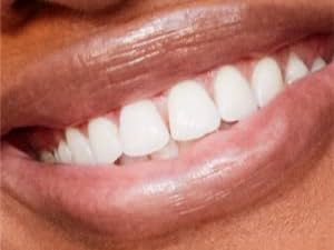 mouth