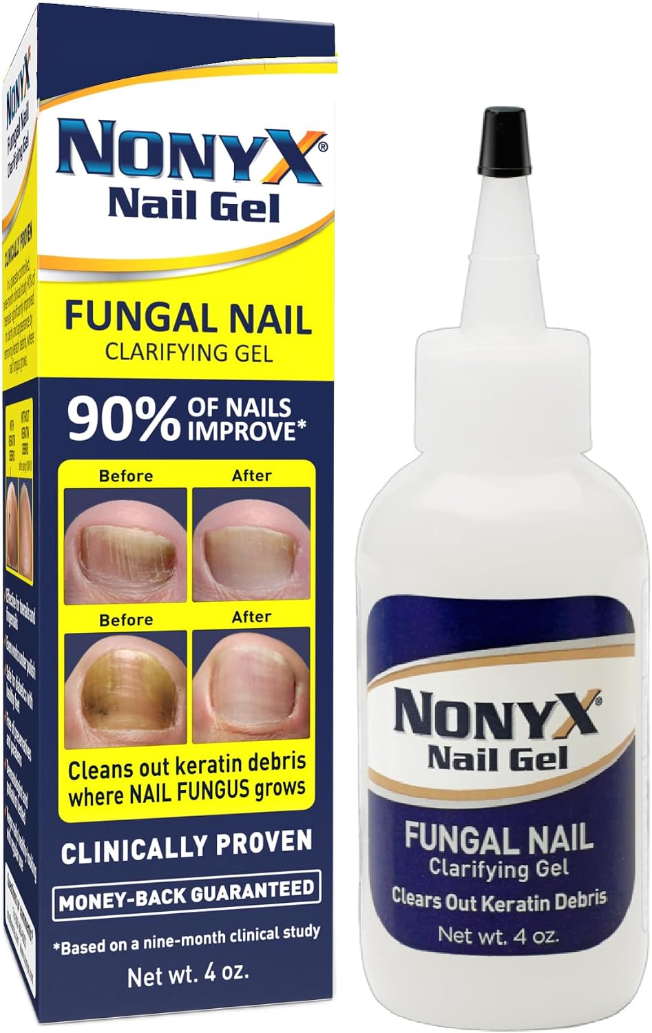 NONYX Fungal Nail Clarifying Gel | Clinically Proven for Discolored, Thick, Brittle, Yellow, Lifted