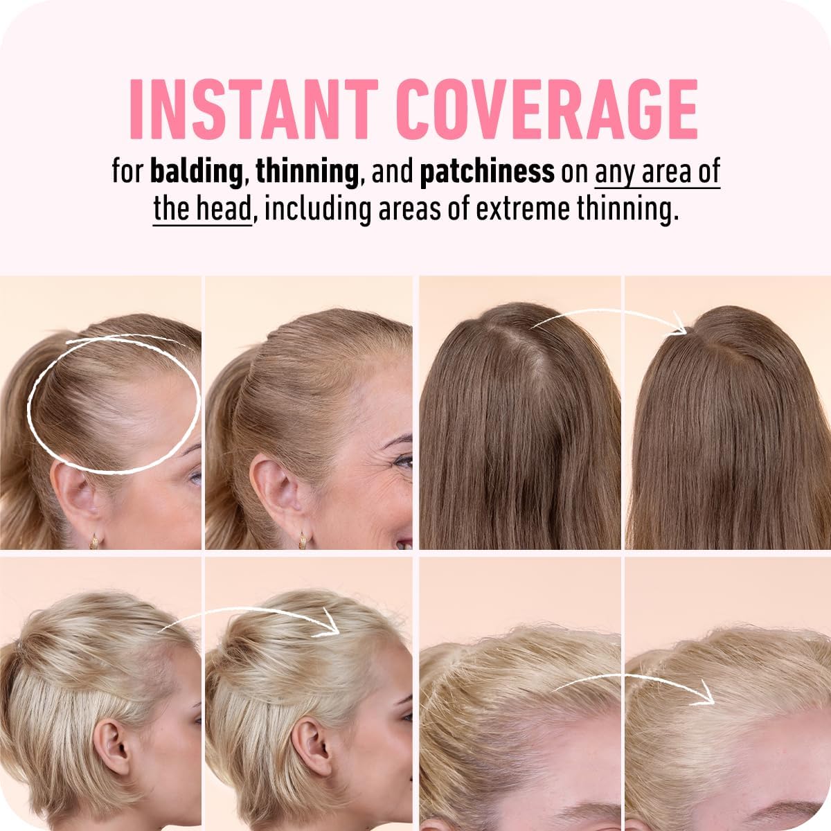 Boldify Hairline Powder, Root Touch Up Hair Color Dark Brown 4g
