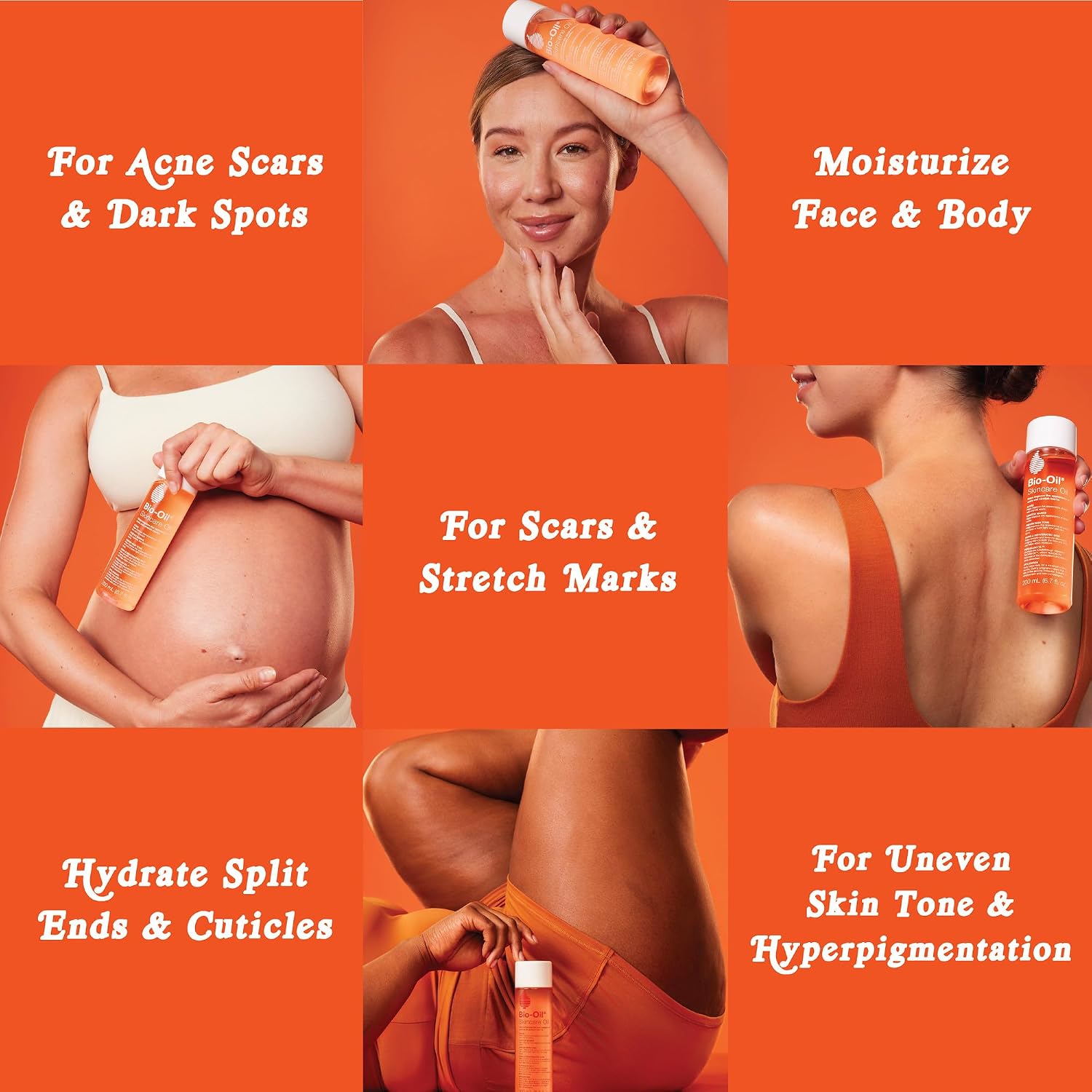 Bio-Oil Skincare Body Oil Serum, Scars & Stretch Marks, 6.7 fl oz | Dermatologist Recommended, Vitamin E & A, Dry & Sensitive Skin, Non-Comedogenic, Face and Body, Scar Treatment