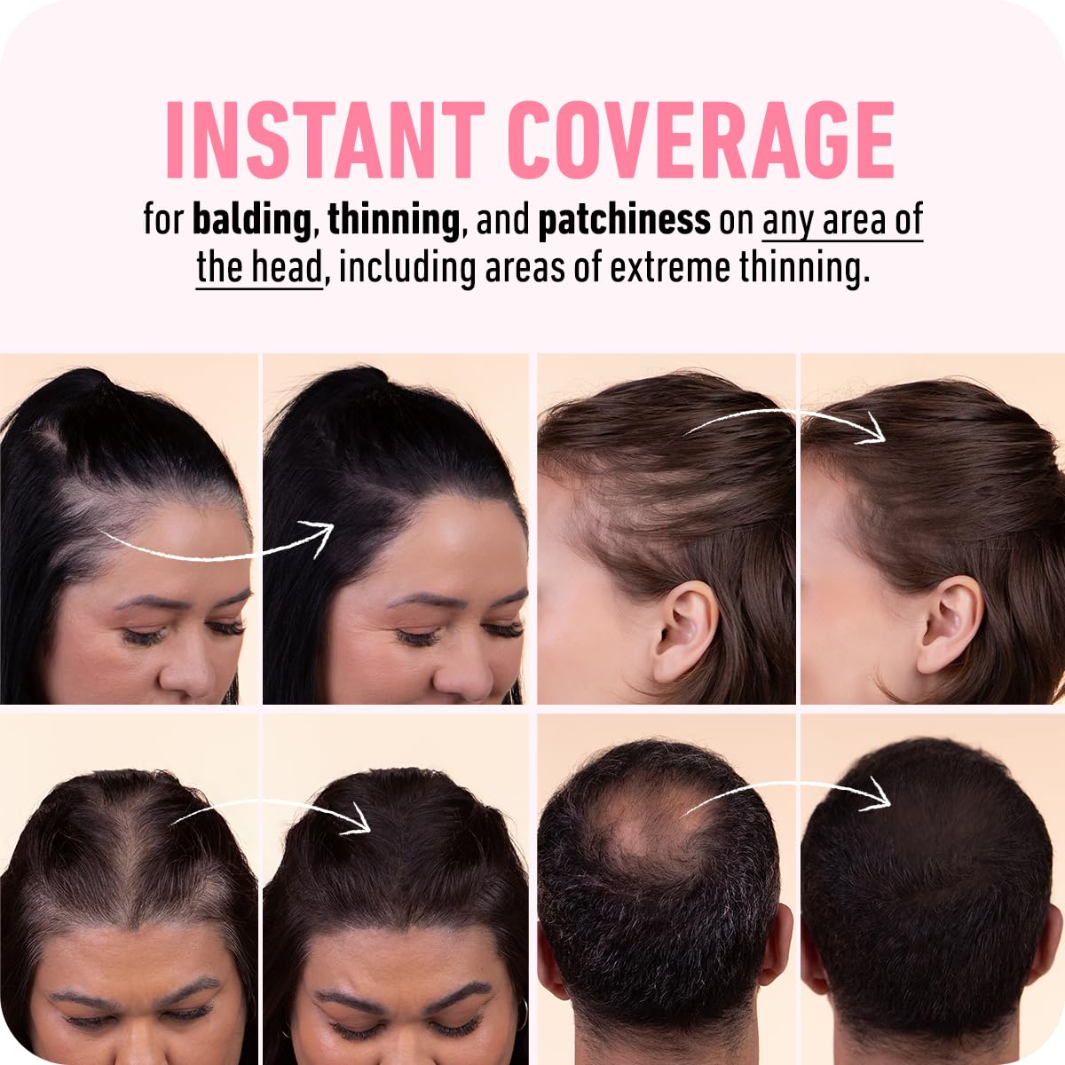 Boldify Hairline Powder, Root Touch Up Hair Color Dark Brown 4g