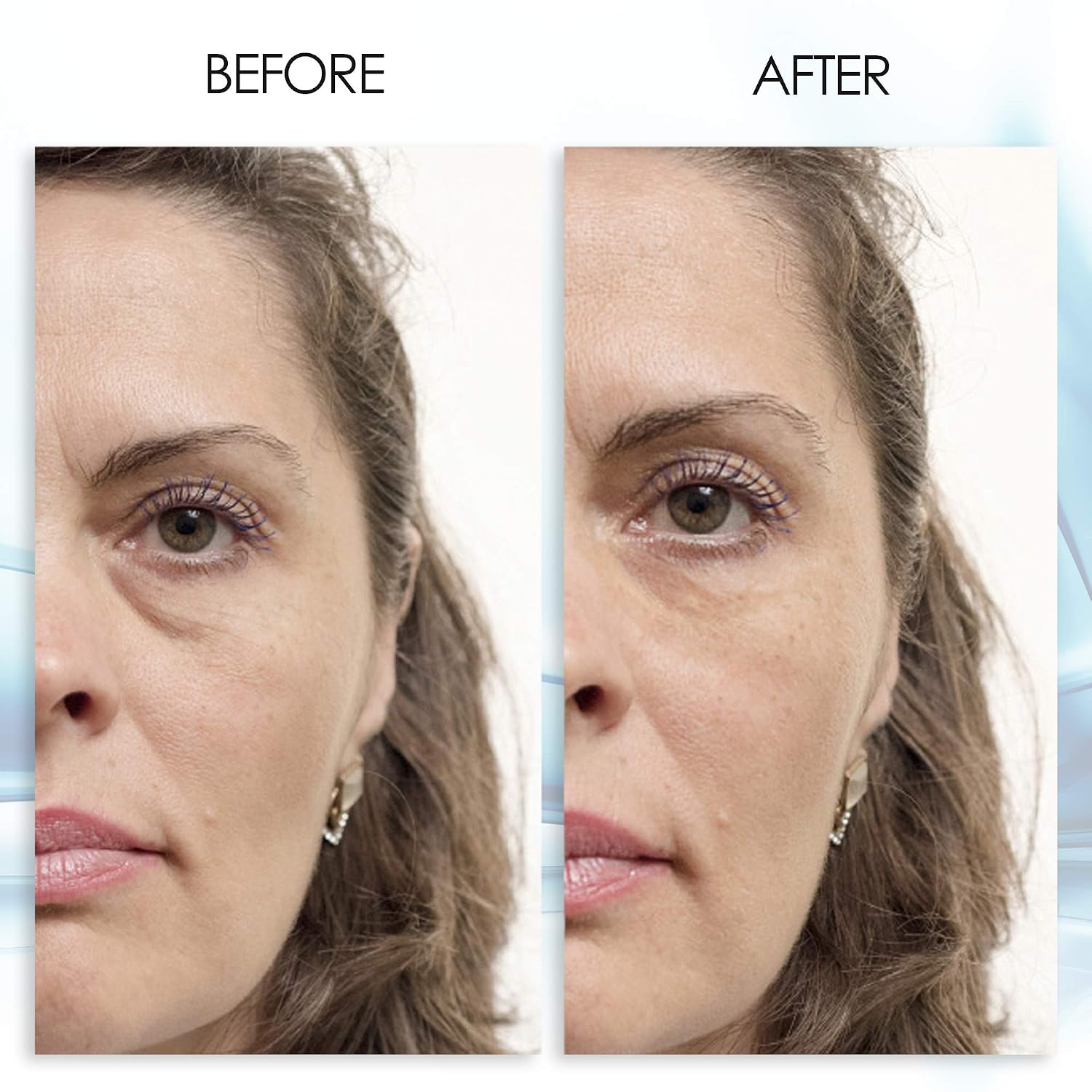 Puffy Eye GEL Instant results – Naturally rapid reduction eye gel, Eliminate Wrinkles