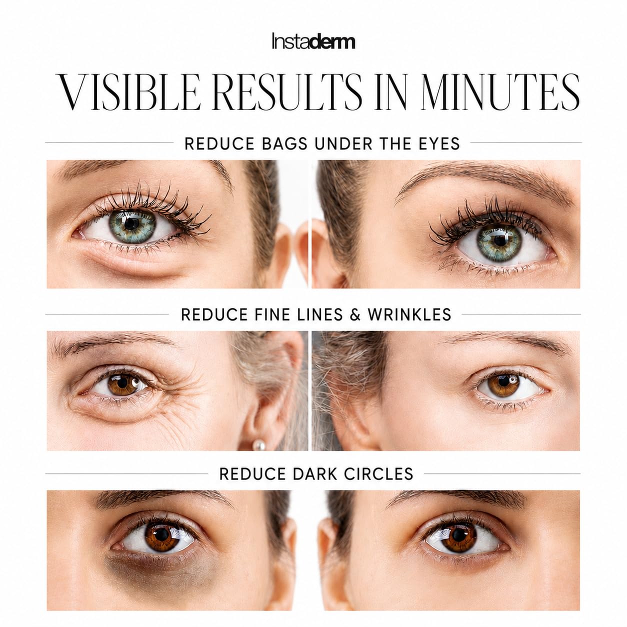 Instant Eye Tightener Cream – Instantly Reduces the Appearance of Under-Eye Bags, Puffiness, Dark Circles, Fine Lines