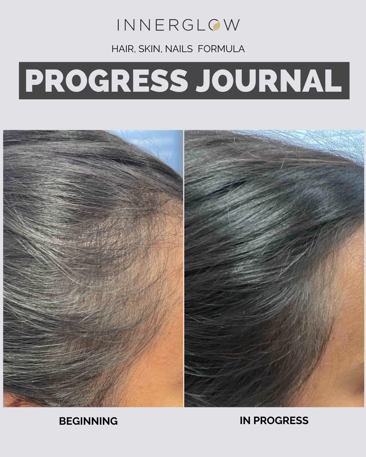 Inner Glow Advanced Hair, Skin & Nails Vitamins – Doctor-Developed Hair Supplement with Biotin, Collagen Peptides