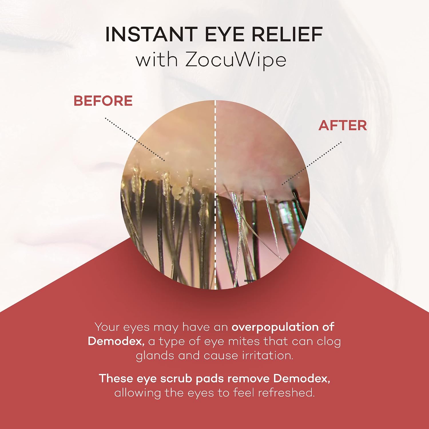 Zocular Zocuwipe Eyelid Wipes, Gentle Cleansing & Moisturizing, 30 Count | Okra-based Cleansing Formula, Eyelid Hygiene, Eyelid Comfort, Individually Wrapped, Rinse Free, Ophthalmologist-Developed