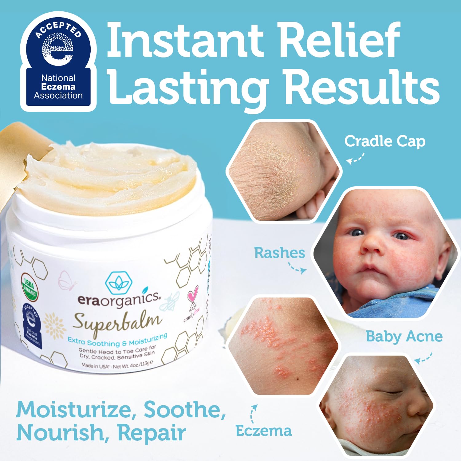 Superbalm USDA Organic Healing Ointment for Baby Eczema & Cradle Cap - 2oz | 100% Natural Soothing Superfood Cream for Toddler & Kids - Eczema, Cradle Cap, Baby Acne & Rashes - Non-Toxic, Fragrance-Free