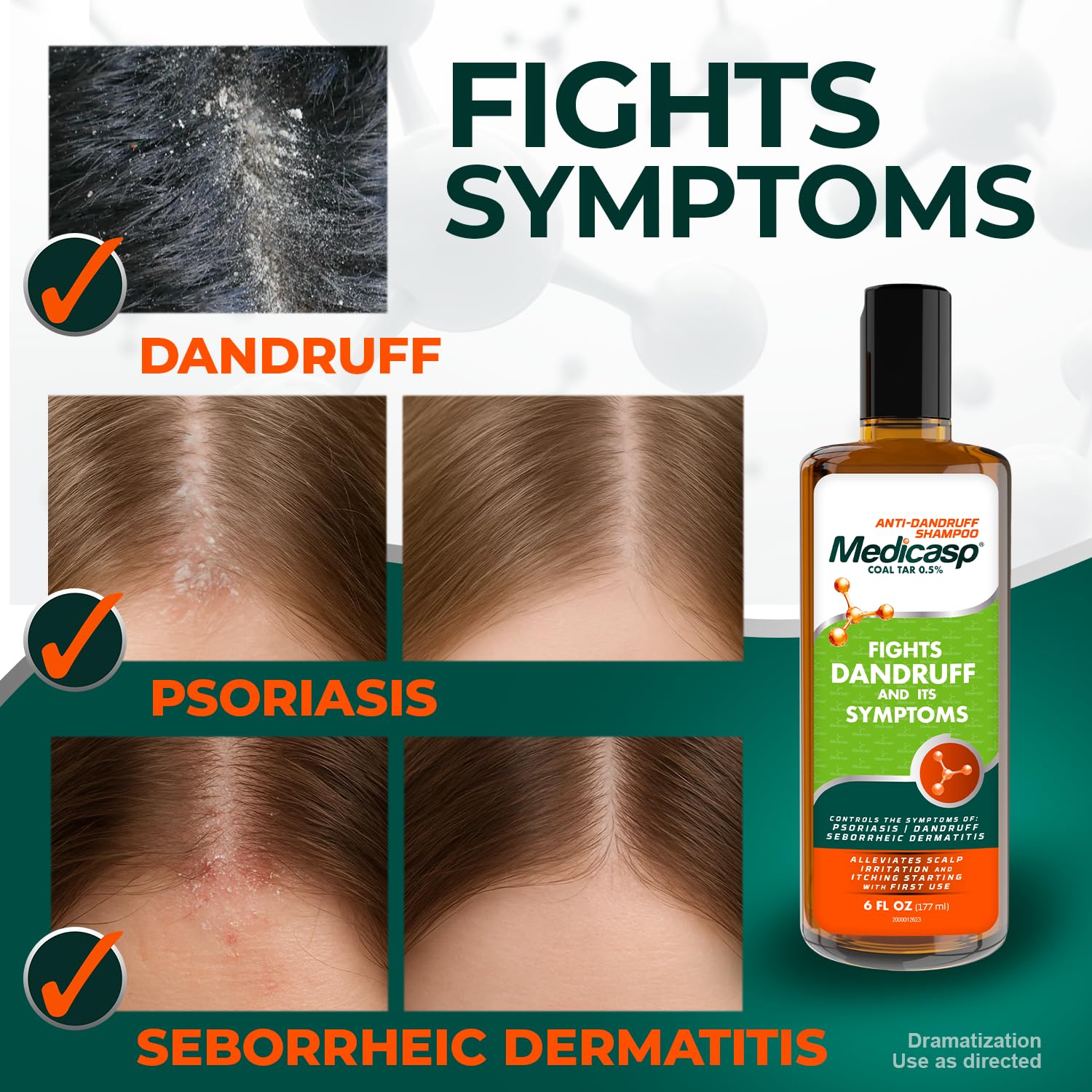Medicasp Coal Tar Anti-Dandruff Shampoo, Flakes Shampoo, 6 fl oz | Alleviates Symptoms from 1st Wash, Treats Psoriasis, Seborrheic Dermatitis & Itchy Dry Scalp, Fights Root Cause of Dandruff