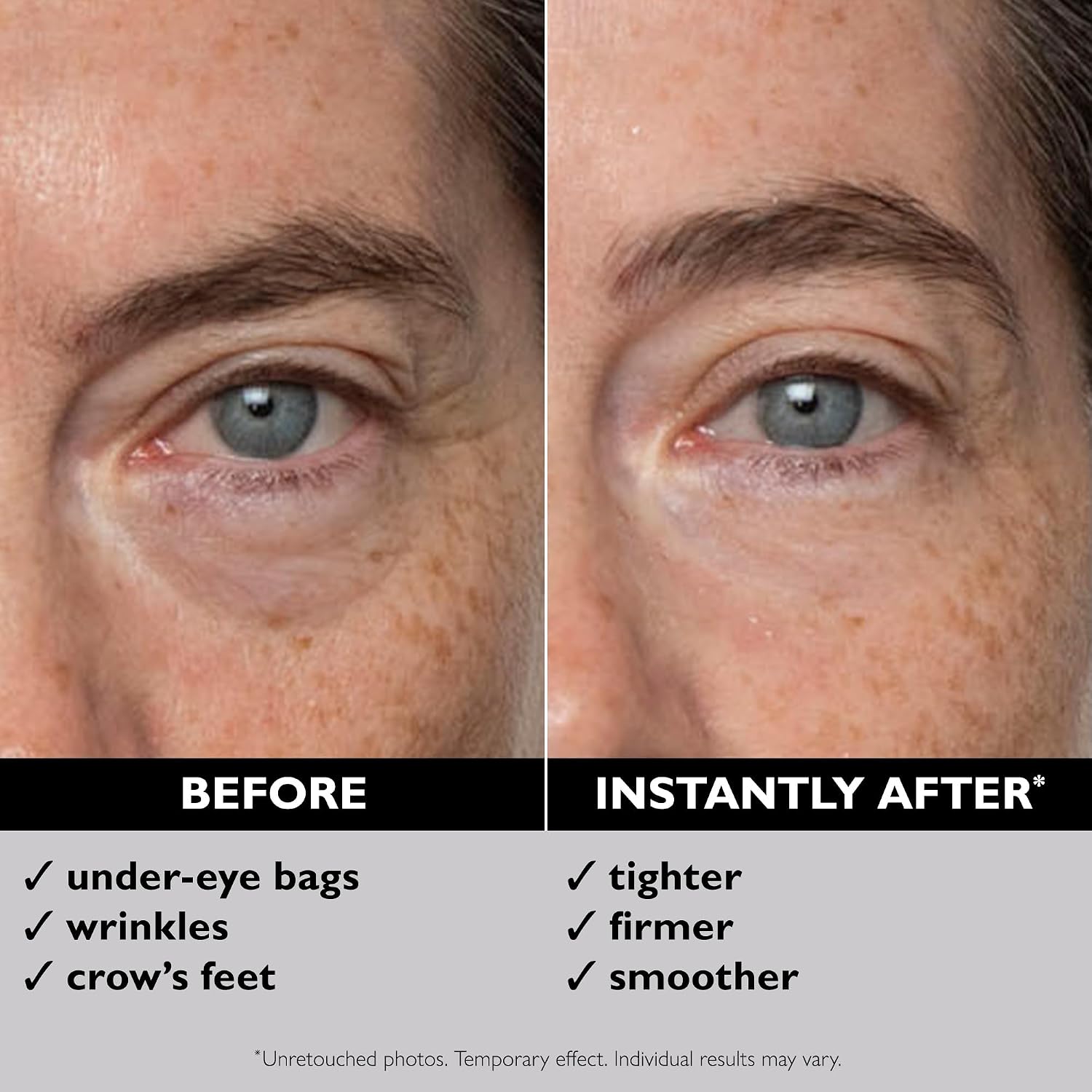 Peter Thomas Roth | Instant FIRMx® Eye Temporary Eye Tightener