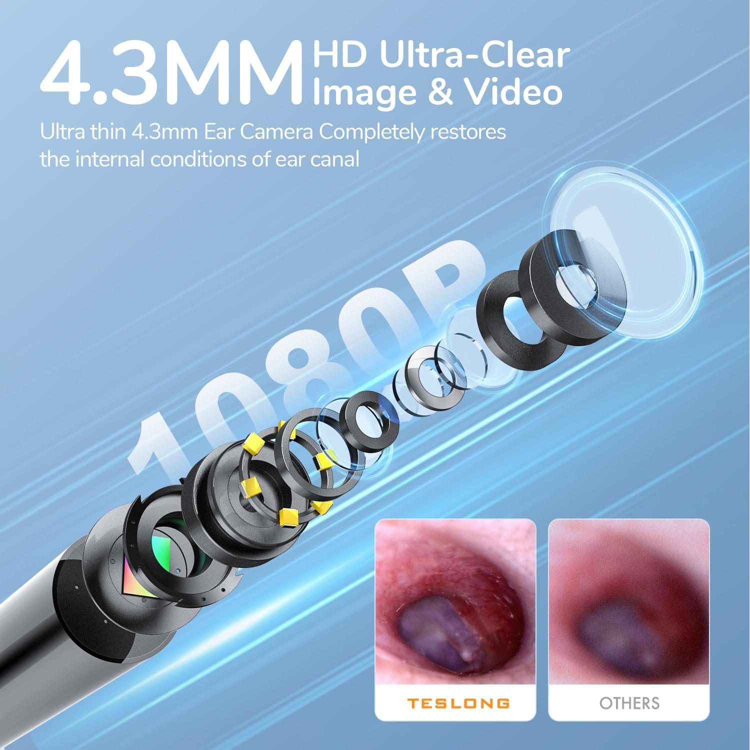 Digital Otoscope with Light 1080P Full HD Otoscope Camera for USB-C Devices | 4.3mm Lens, 6 LED Lights, Waterproof Ear Camera for Ear Viewing