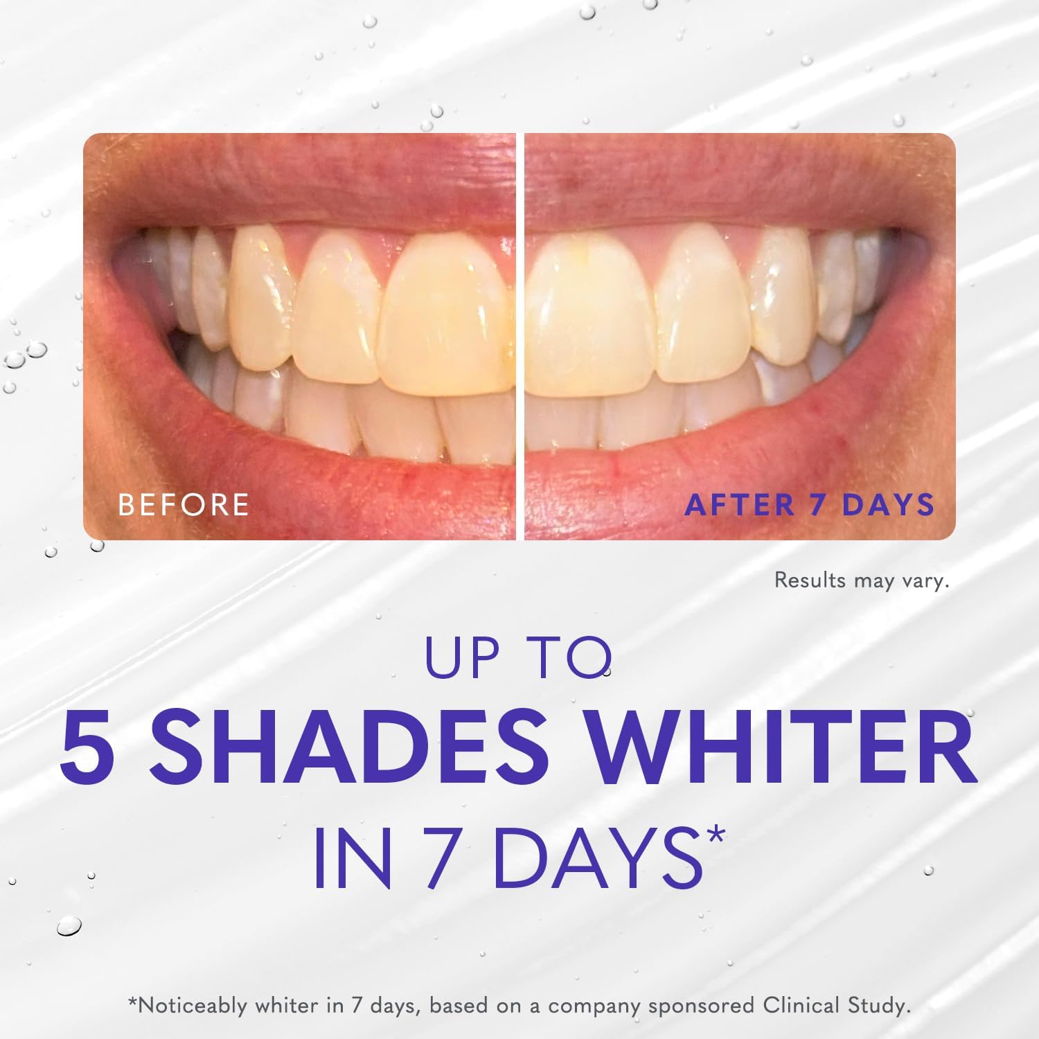 Smileactives Teeth Whitening Kit with Gel & Pen, Hydrogen Peroxide, 30-Day
