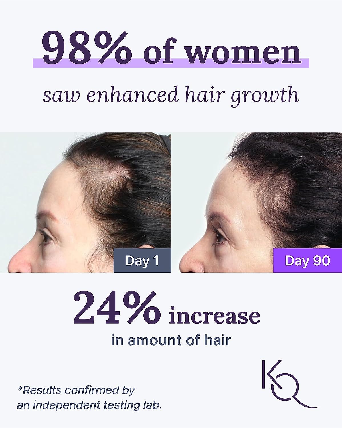 Keranique Hair Growth System - KeraViatin Vitamins with Biotin, Vitamin B, and Curcumin, Lift and Repair Treatment Spray for Instant Volume