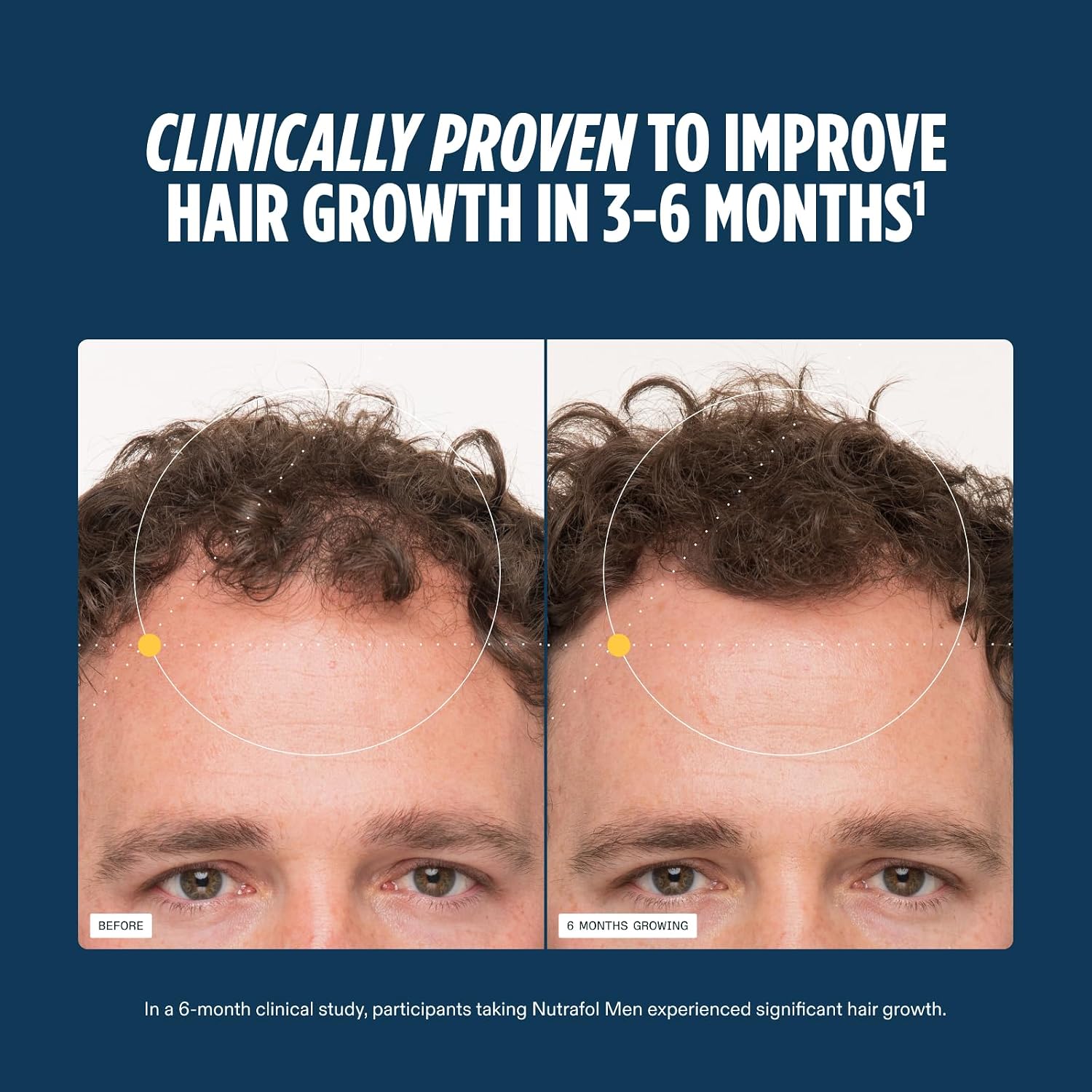 Nutrafol Men Hair Growth Supplements, Ages 18-49, 1-Month Bottle