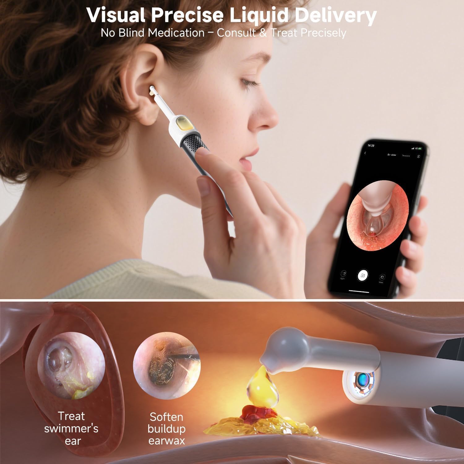 BEBIRD R1 Ultra Ear Wax Removal Tweezers:1296P HD Ear Camera Cleaner, Black